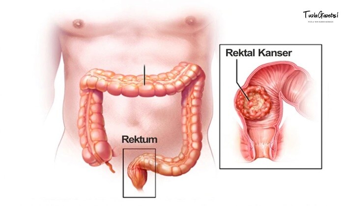 Rektum Anatomisi ve Fonksiyonu Nedir?  