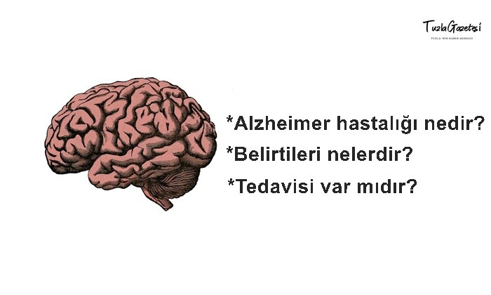 Alzheimer hastalığı nedir