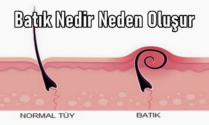 Batık Nedir Neden Oluşur