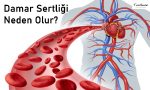 Damar Sertliği Neden Olur