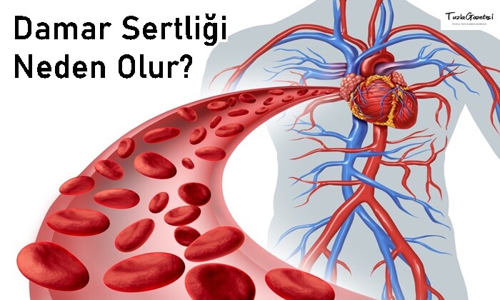 Damar Sertliği Neden Olur