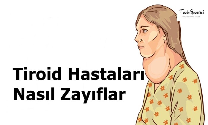 Tiroid Hastaları Nasıl Zayıflar