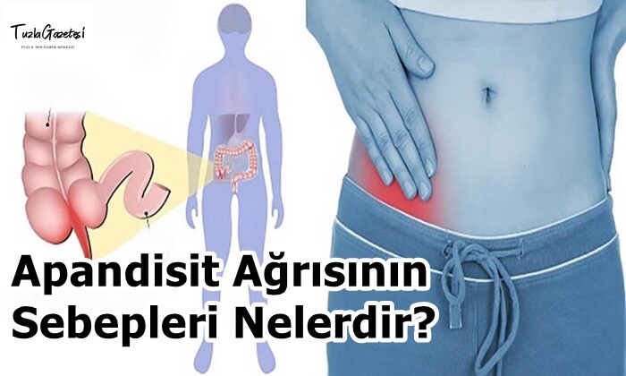 Apandisit Ağrısının Sebepleri Nelerdir?