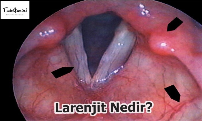 Larenjit Nedir?