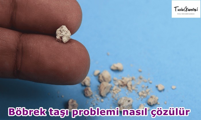 Böbrek taşı problemi nasıl çözülür?