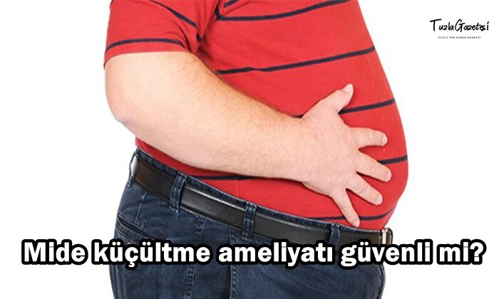 Mide küçültme ameliyatı güvenli mi