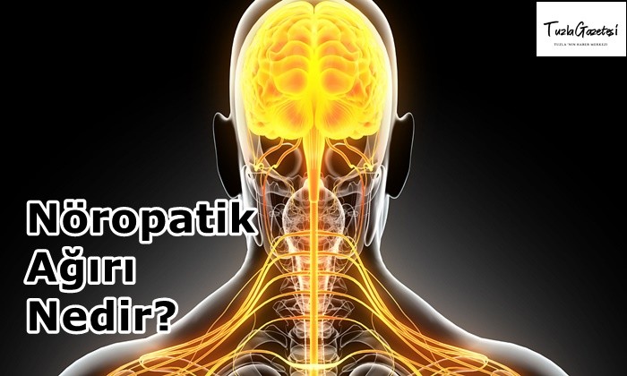 Nöropatik Ağırı Nedir