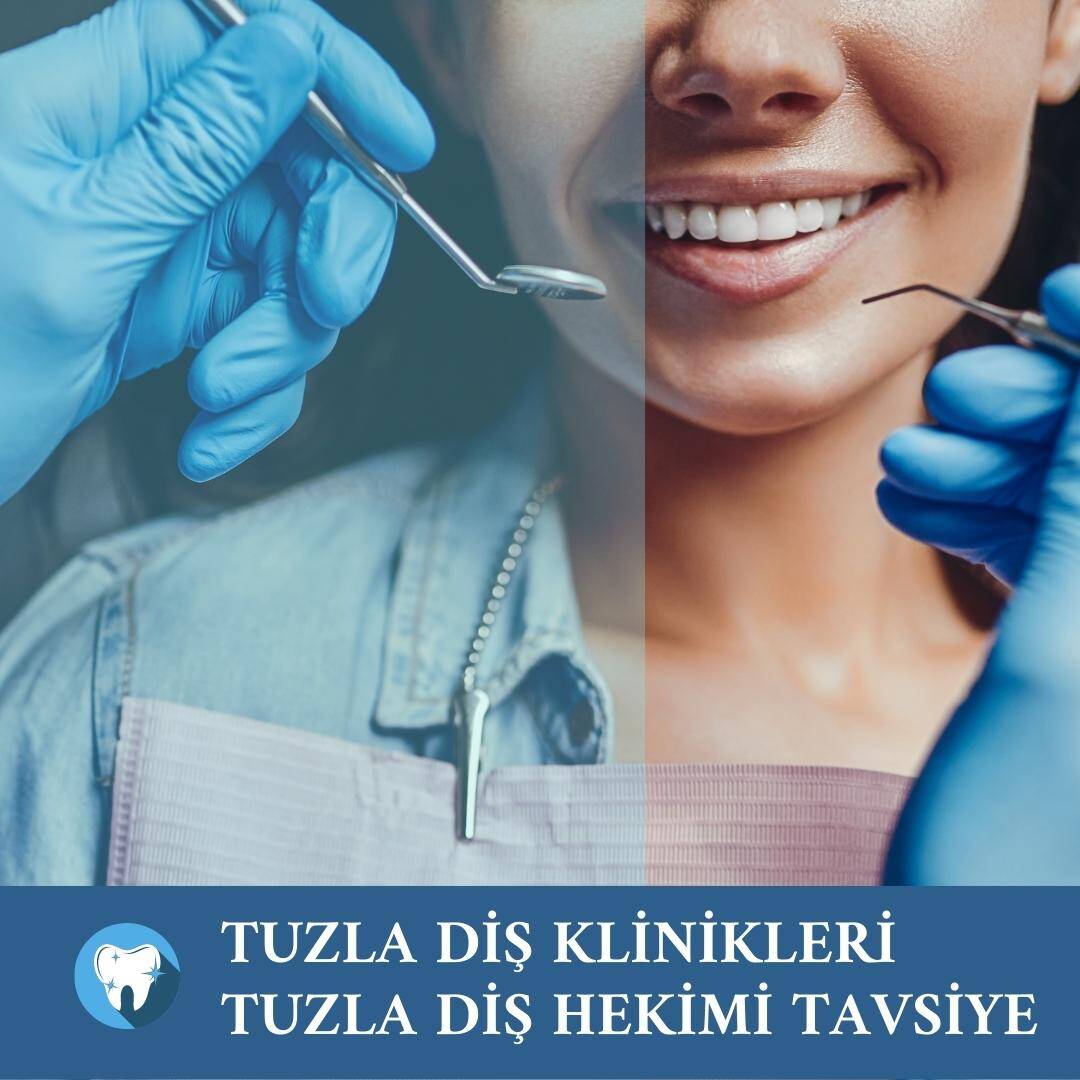 Tuzla Diş Klinikleri Tuzla Diş Hekimi Tavsiye randevu